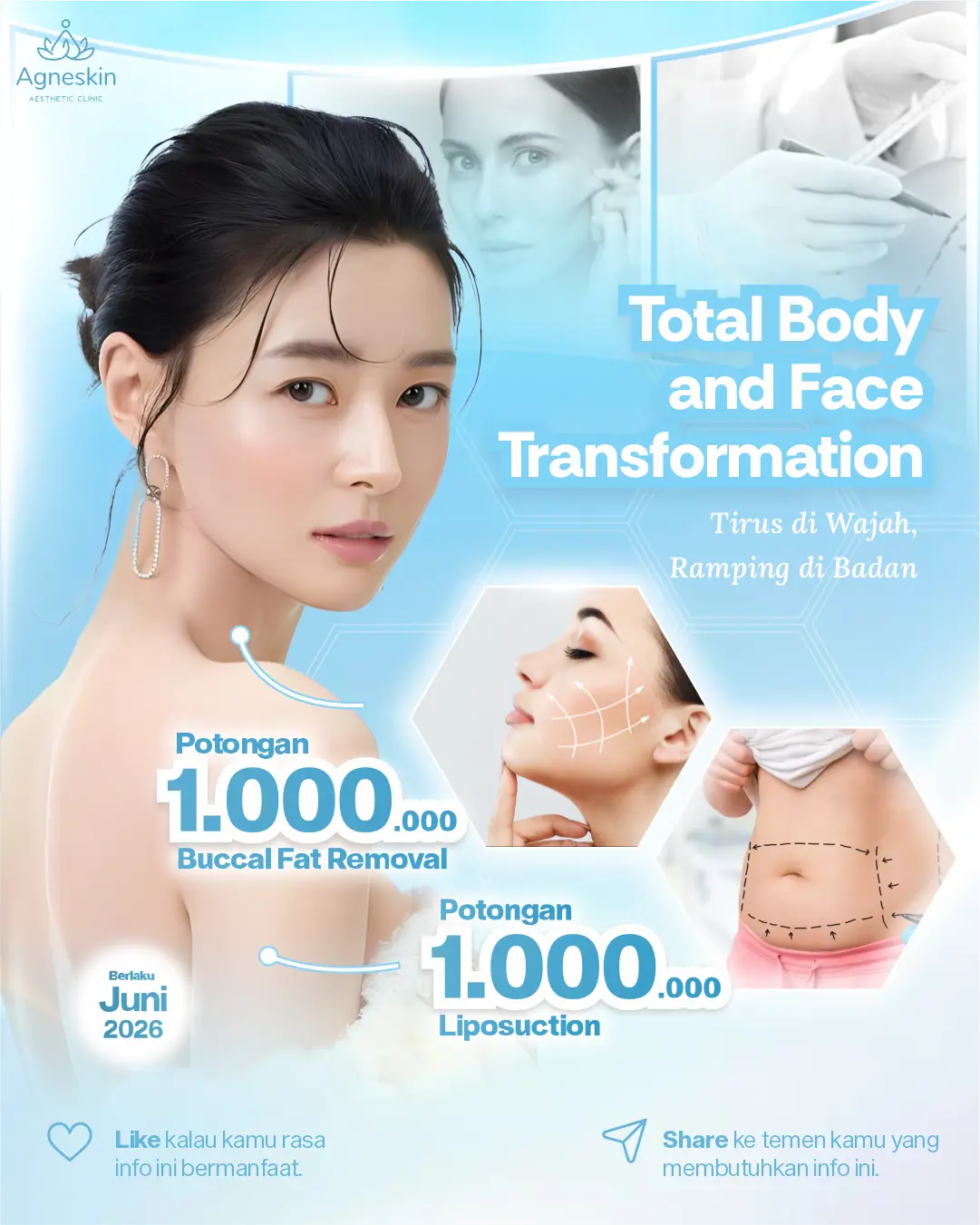 Promo Mini Surgery Juni 2026